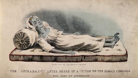 Cholera Patient from 1854